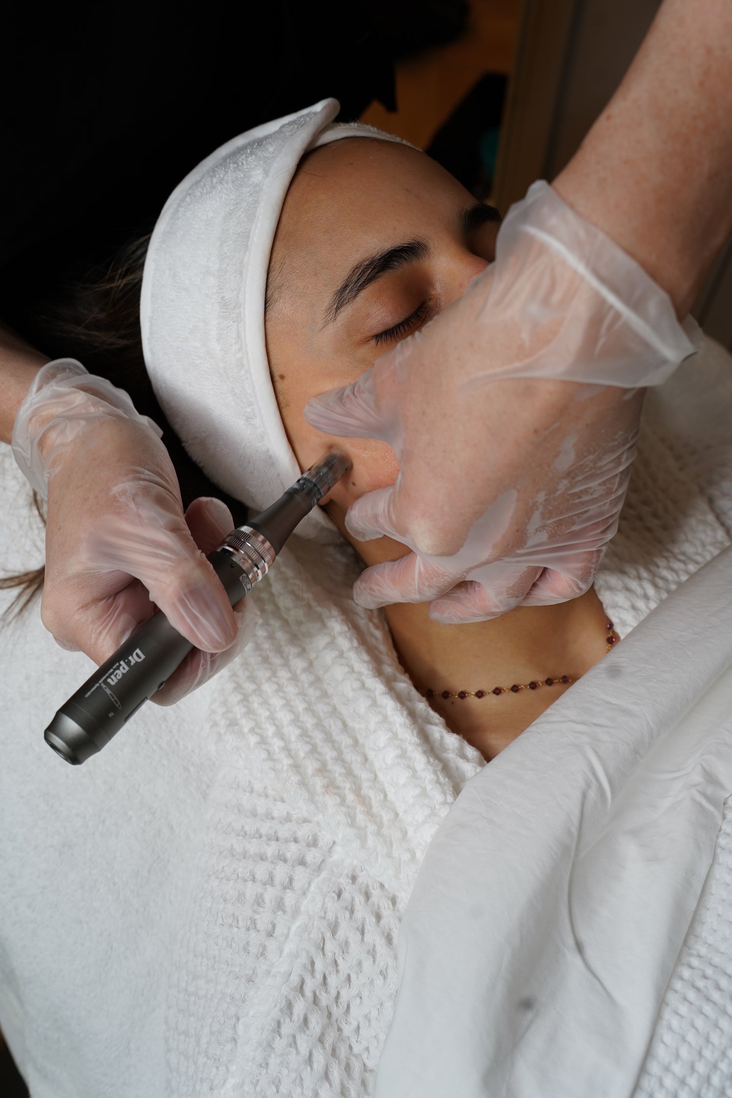 Tratamiento Facial Dermapen a Domicilio en Madrid