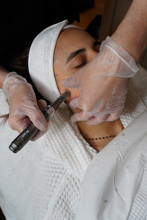 Tratamiento Facial Dermapen a Domicilio en Madrid