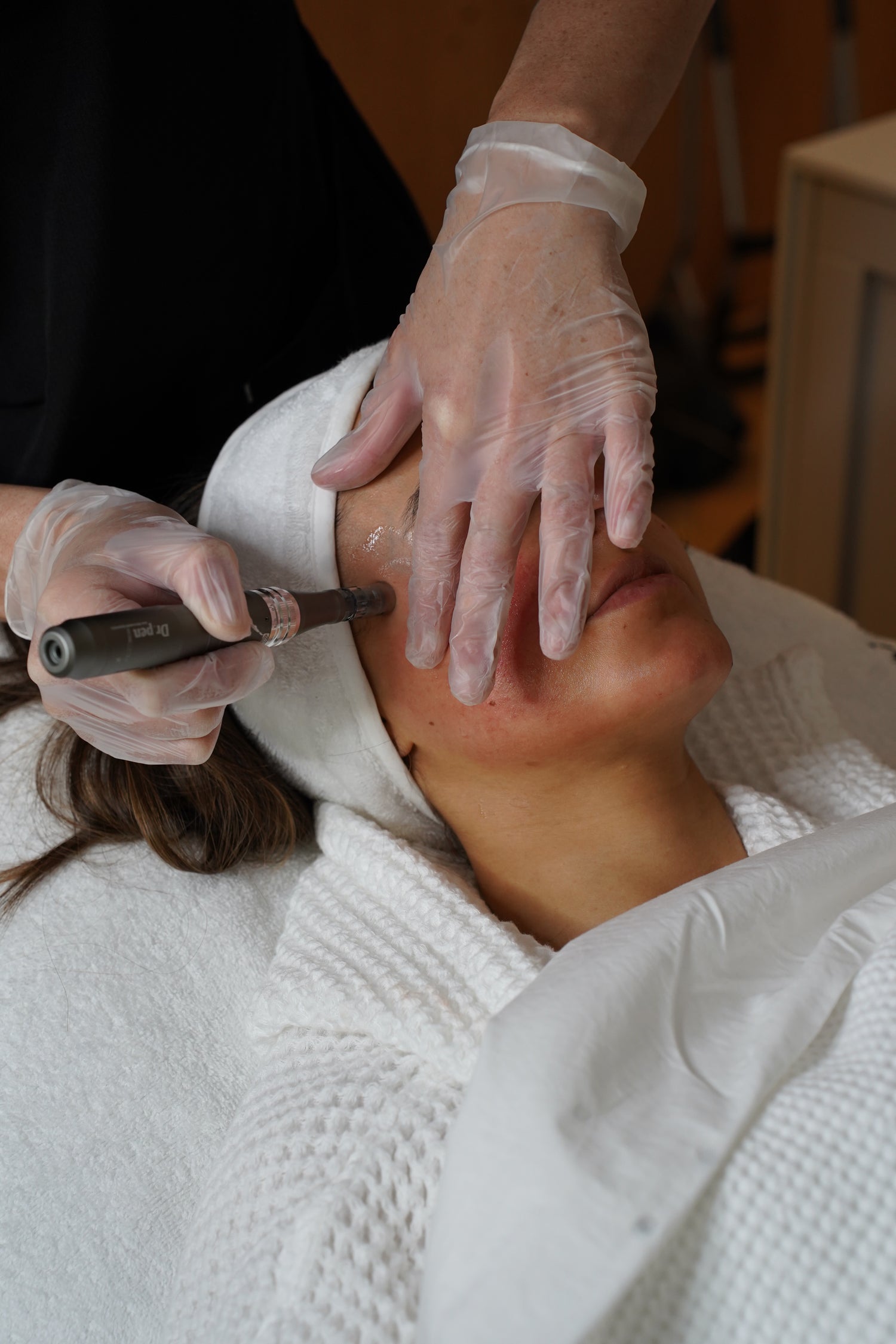 Tratamiento Facial Dermapen a Domicilio en Madrid