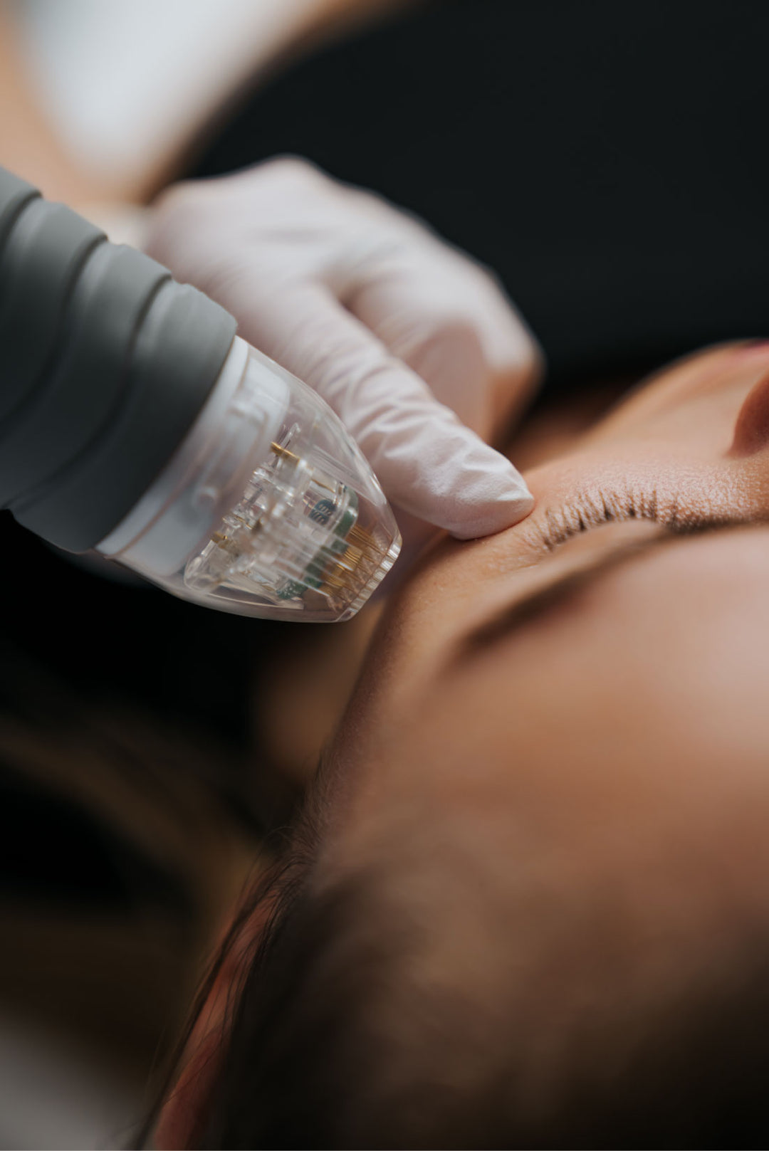 Rejuvenecimiento Facial con Exosomas a Domicilio en Madrid